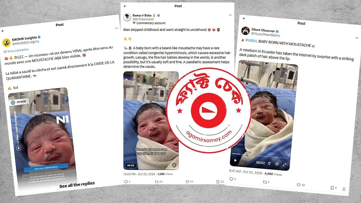 নবজাতকের মুখে গোঁফ থাকার ভাইরাল ভিডিওটি কি আসল
